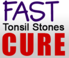 Fast Tonsil Stones Cure Coupons