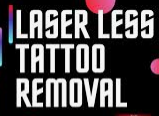 Laserless Tattoo Removal Coupons