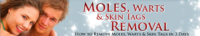 Moles Warts & Skin Tags Removal Coupons